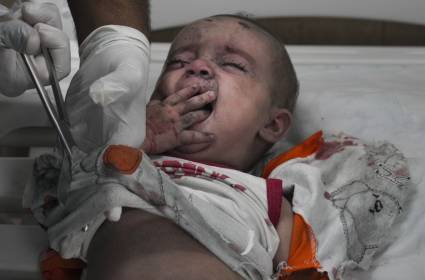 واشنطن في المأزق مجدداً: "فتاة النابالم" في غزة؟ 
