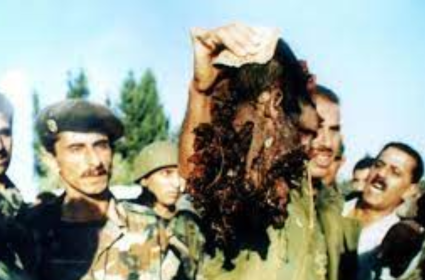عملية حزب الله: كمين الأنصارية
